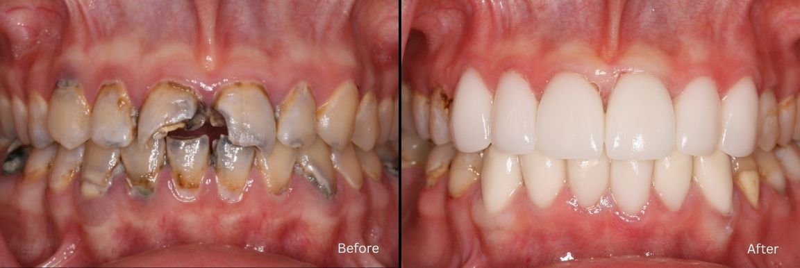 Smile Gallery Before and After