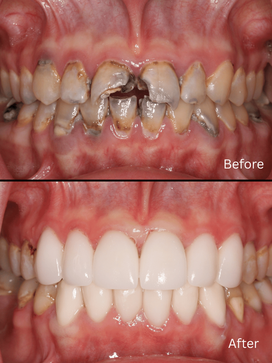 Smile Gallery Before and After