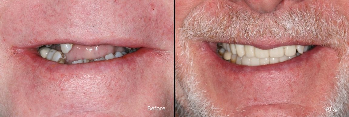 Dental Smile Results