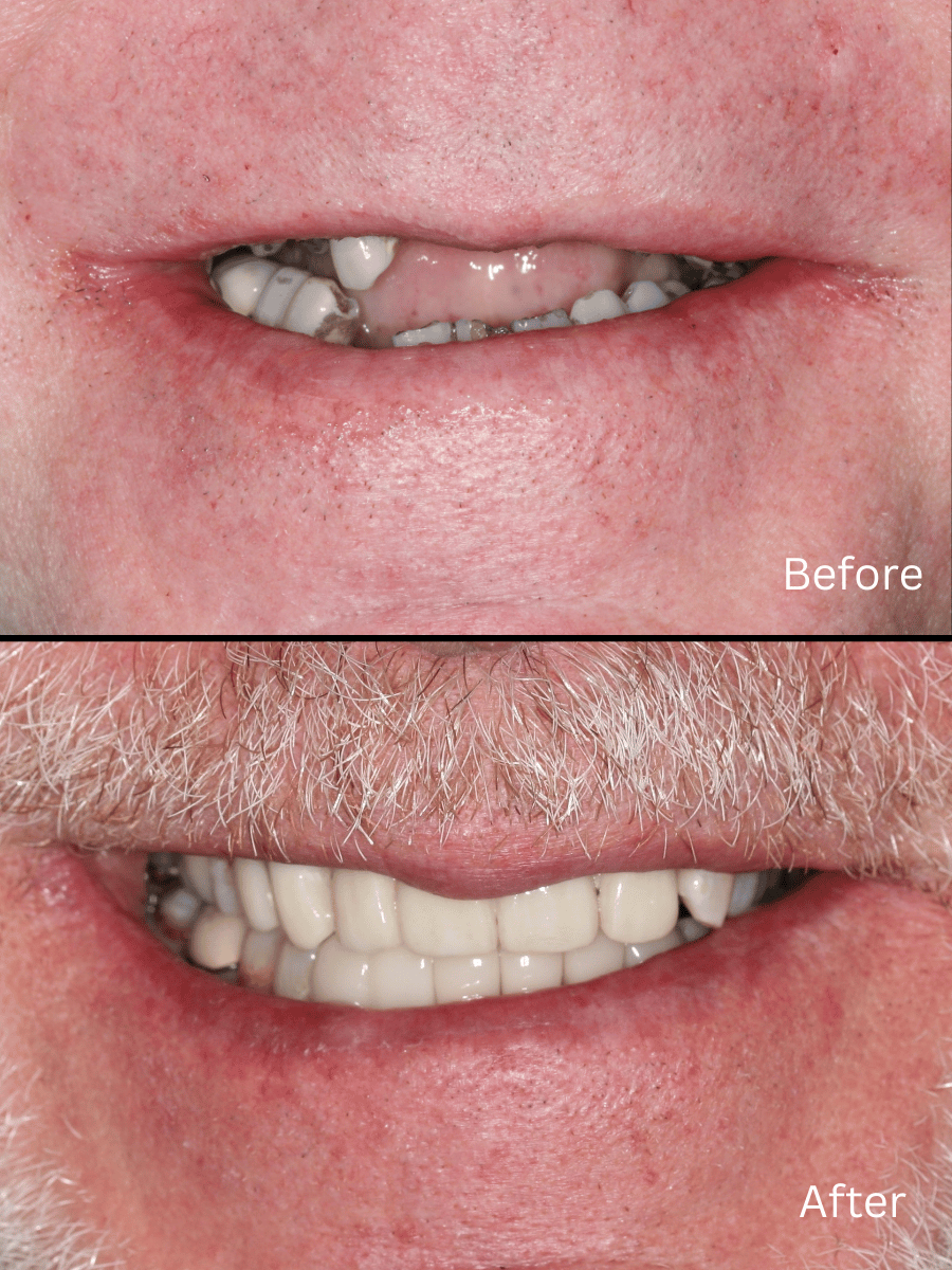 Dental Smile Results