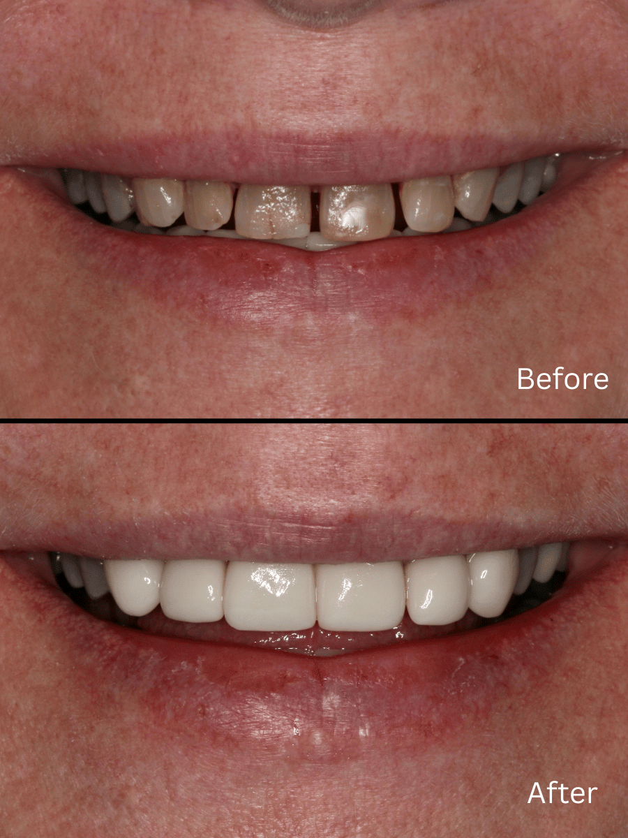 Patient Smile Makeover