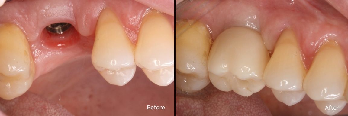 Dental Smile Gallery