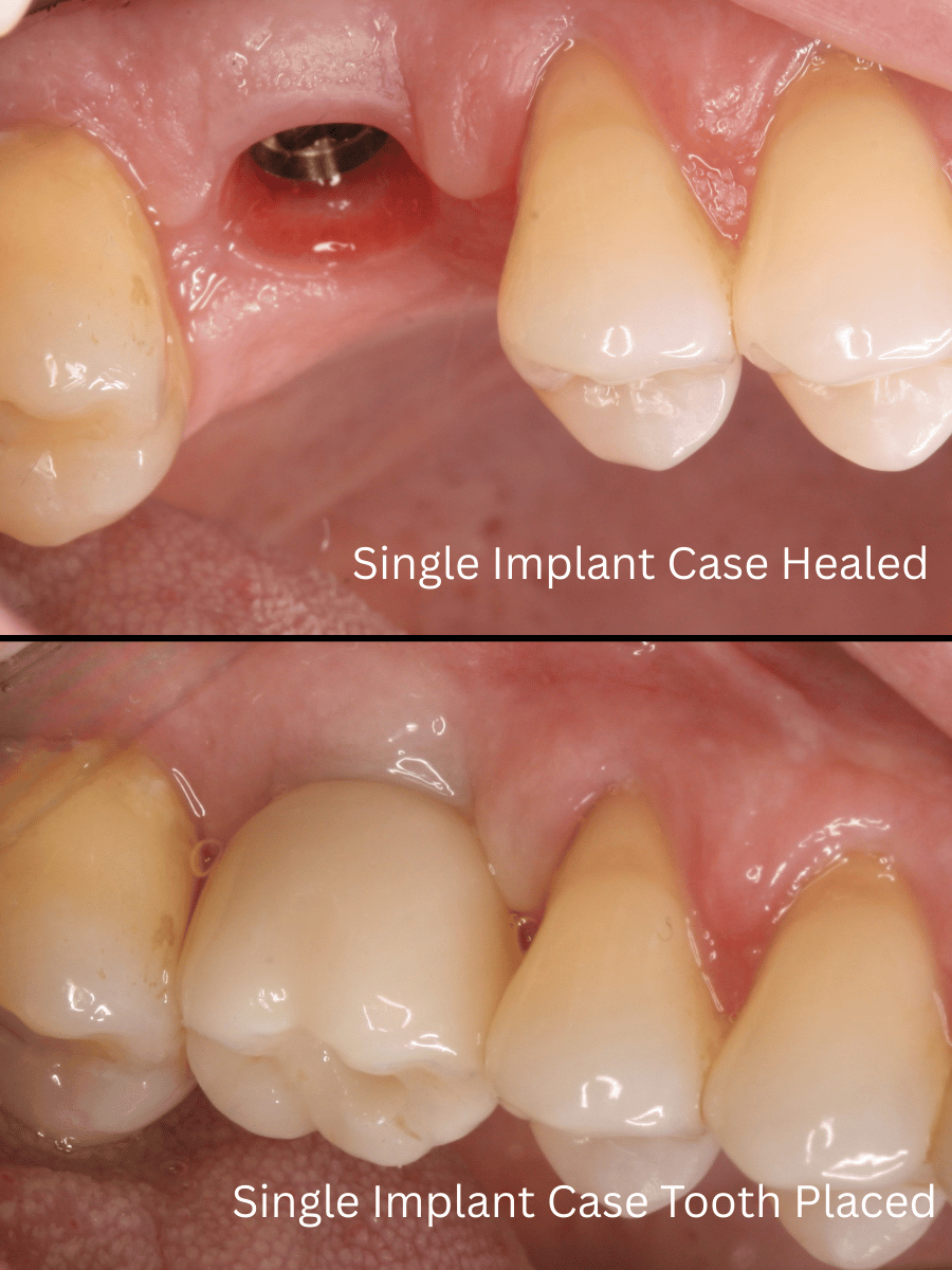 Dental Smile Gallery