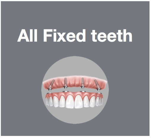 Replace all teeth with fixed implants