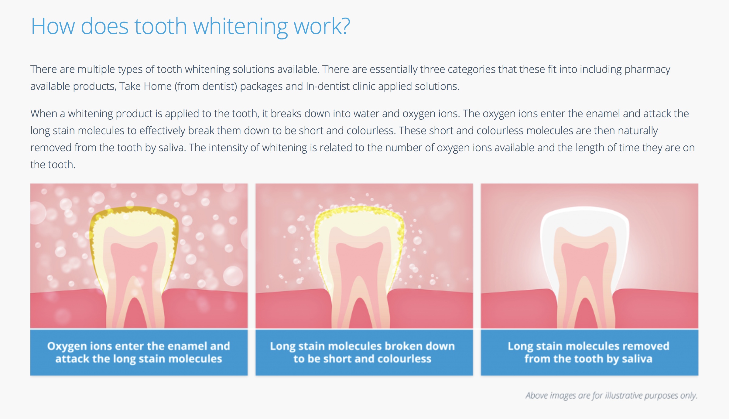 Whiten Teeth For A Brighter More Confident Smile | Fishers ...